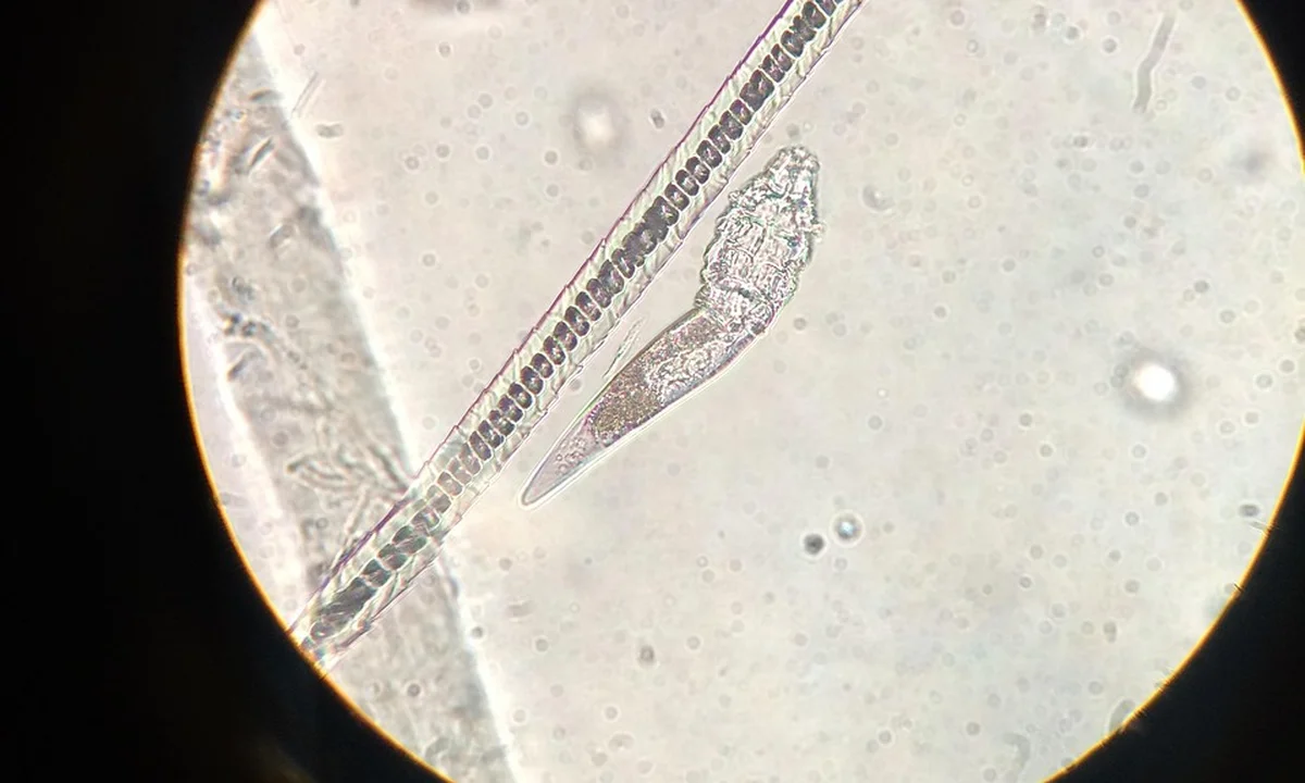 Microscope image of a tiny arthropod near tarantula enclosure material, illustrating potential external parasites